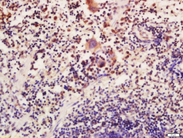 ATG16L Antibody in Immunohistochemistry (Paraffin) (IHC (P))