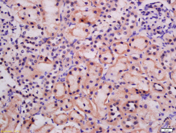 ATG9A Antibody in Immunohistochemistry (Paraffin) (IHC (P))