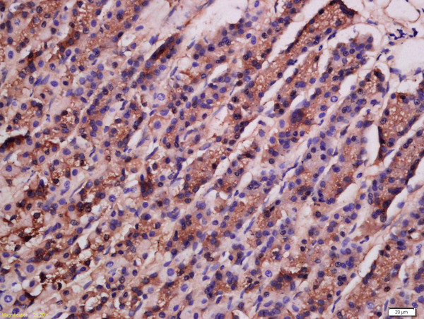 ATG9A Antibody in Immunohistochemistry (Paraffin) (IHC (P))