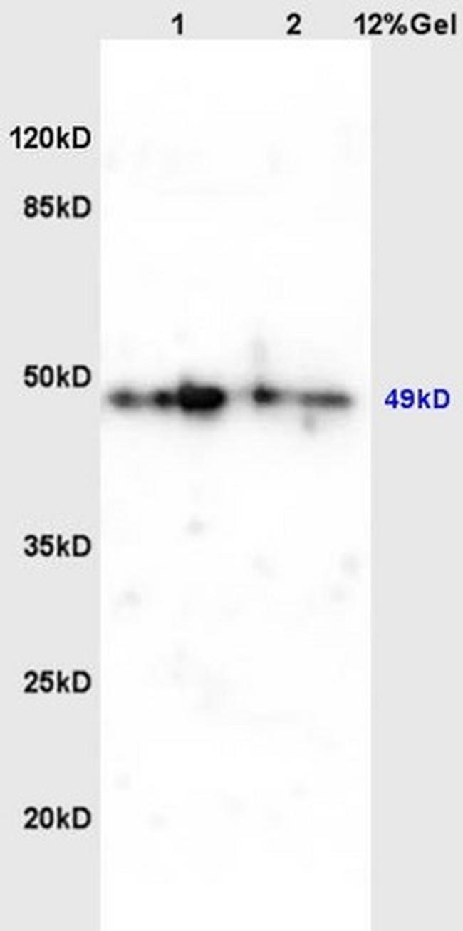 Phospho-C-MycThr358 (Thr358) Antibody in Western Blot (WB)