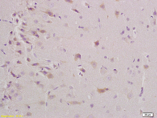 Triosephosphate isomerase Antibody in Immunohistochemistry (Paraffin) (IHC (P))