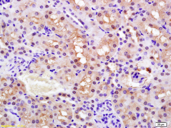 Phospho-PPAR alpha (Ser12) Antibody in Immunohistochemistry (Paraffin) (IHC (P))