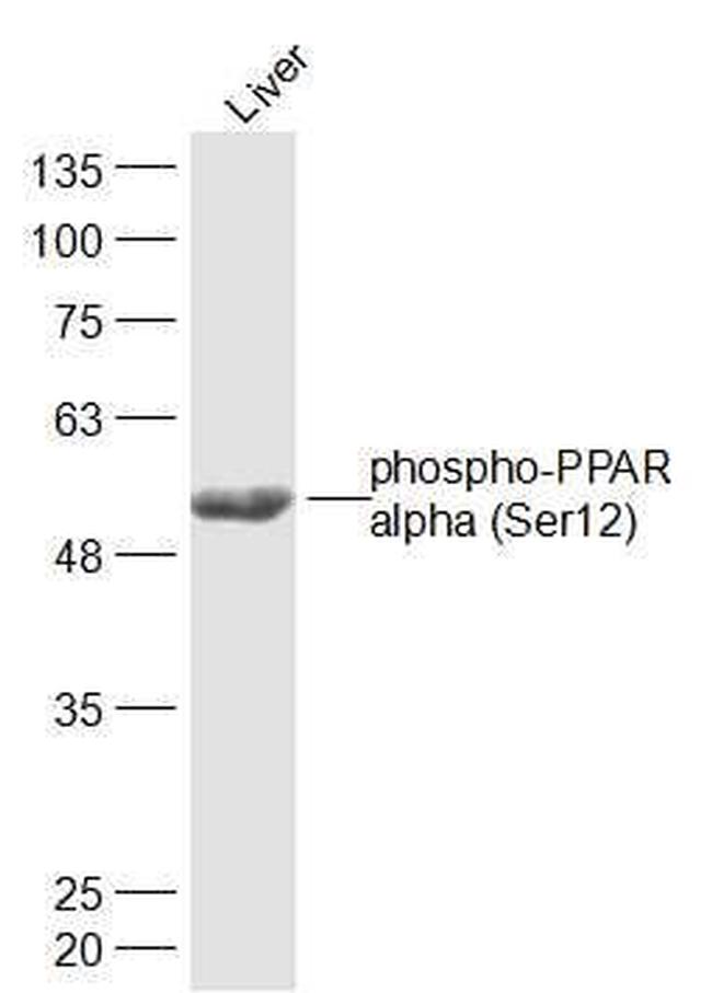 Phospho-PPAR alpha (Ser12) Antibody in Western Blot (WB)