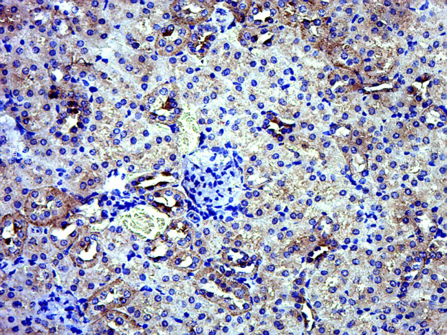 GPD2 Antibody in Immunohistochemistry (Paraffin) (IHC (P))