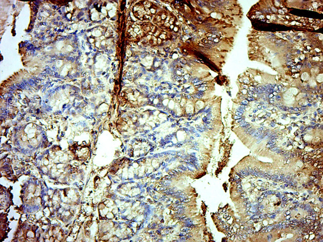 GPD2 Antibody in Immunohistochemistry (Paraffin) (IHC (P))