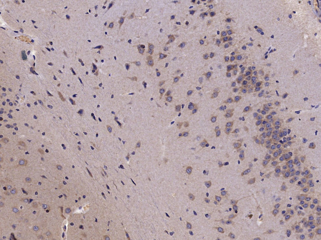 Phospho-HMGCR (Ser872) Antibody in Immunohistochemistry (Paraffin) (IHC (P))