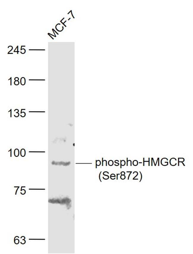 Phospho-HMGCR (Ser872) Antibody in Western Blot (WB)