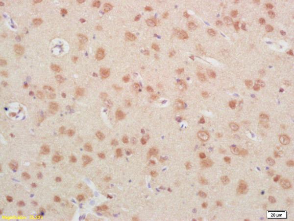 IGFBP6 Antibody in Immunohistochemistry (Paraffin) (IHC (P))