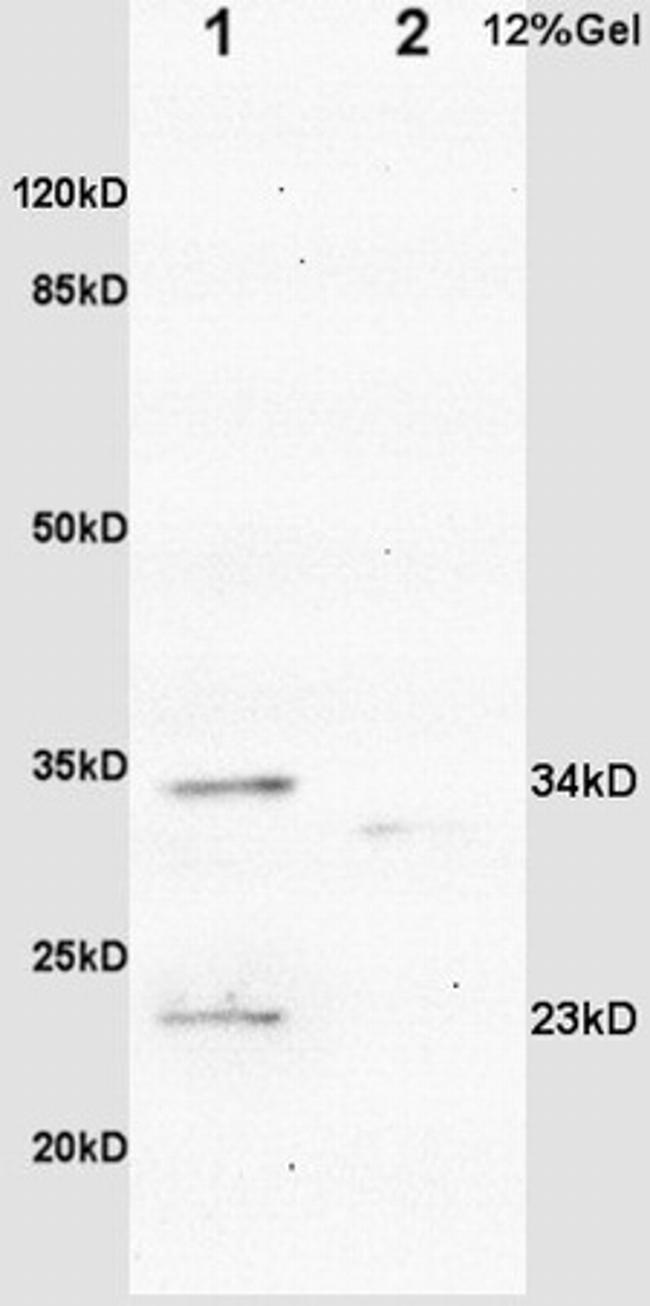 IGFBP6 Antibody in Western Blot (WB)