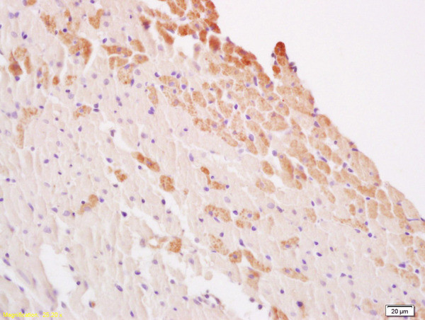 LATS1/2 Antibody in Immunohistochemistry (Paraffin) (IHC (P))