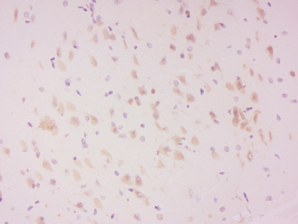 Phospho-LATS2 (Ser83) Antibody in Immunohistochemistry (Paraffin) (IHC (P))