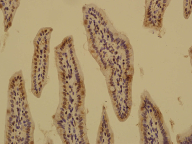 ASAP1 Antibody in Immunohistochemistry (Paraffin) (IHC (P))