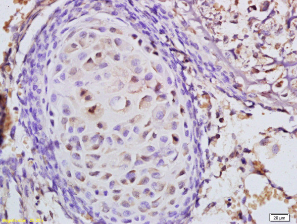 CARM1 Antibody in Immunohistochemistry (Paraffin) (IHC (P))