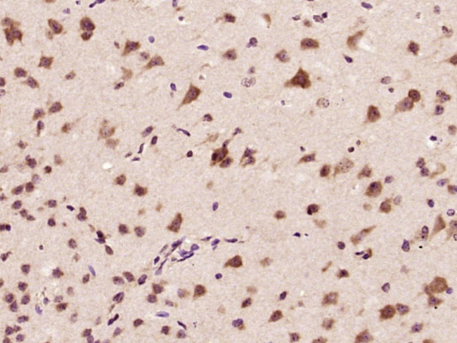 CARM1 Antibody in Immunohistochemistry (Paraffin) (IHC (P))