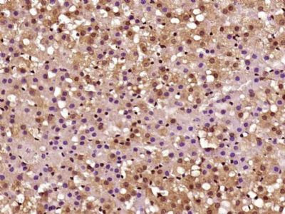 CARM1 Antibody in Immunohistochemistry (Paraffin) (IHC (P))