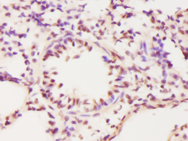 ECT2 Antibody in Immunohistochemistry (Paraffin) (IHC (P))