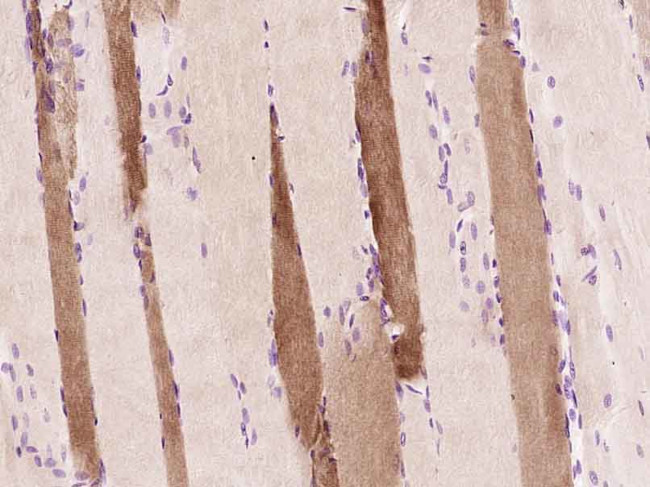 Myoglobin Antibody in Immunohistochemistry (Paraffin) (IHC (P))