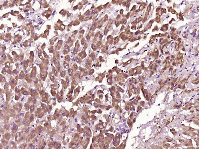 Myoglobin Antibody in Immunohistochemistry (Paraffin) (IHC (P))