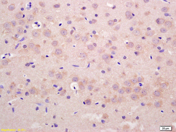 GIT1 Antibody in Immunohistochemistry (Paraffin) (IHC (P))