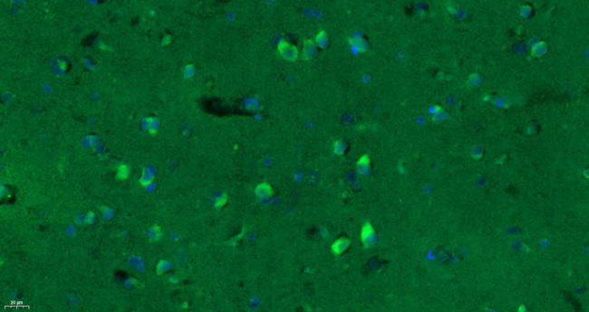 GABA A Receptor gamma 2 Antibody in Immunohistochemistry (Paraffin) (IHC (P))