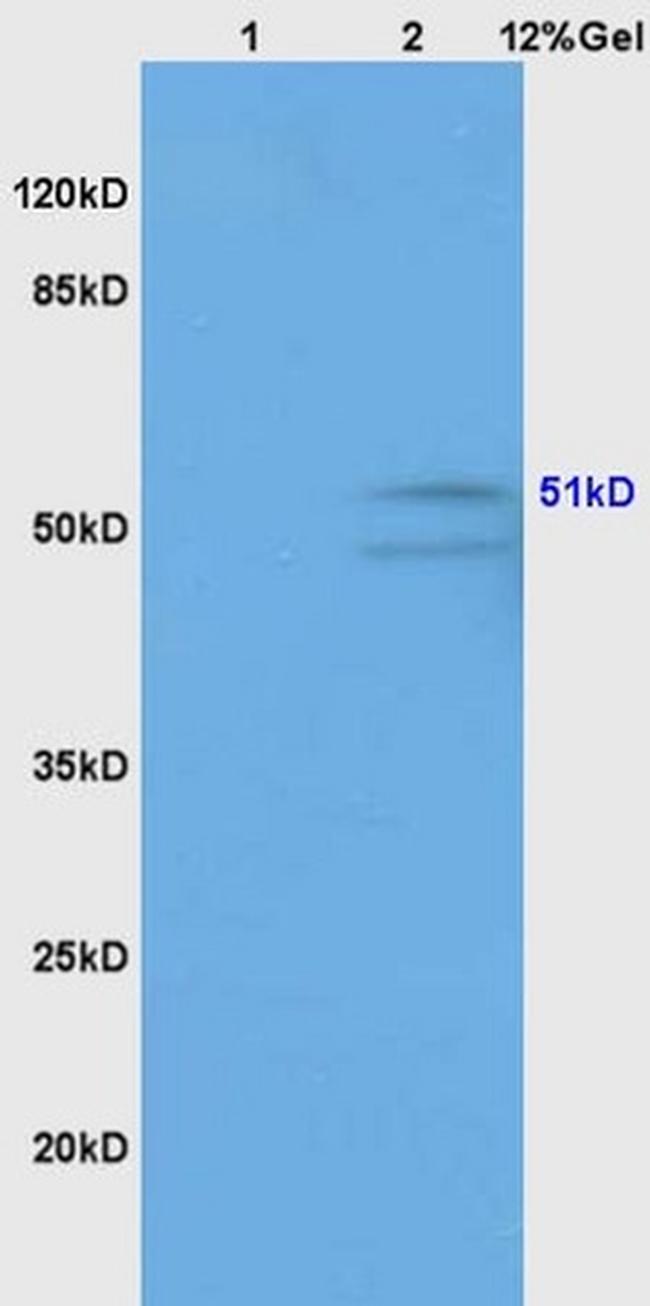 GABA A Receptor gamma 2 Antibody in Western Blot (WB)