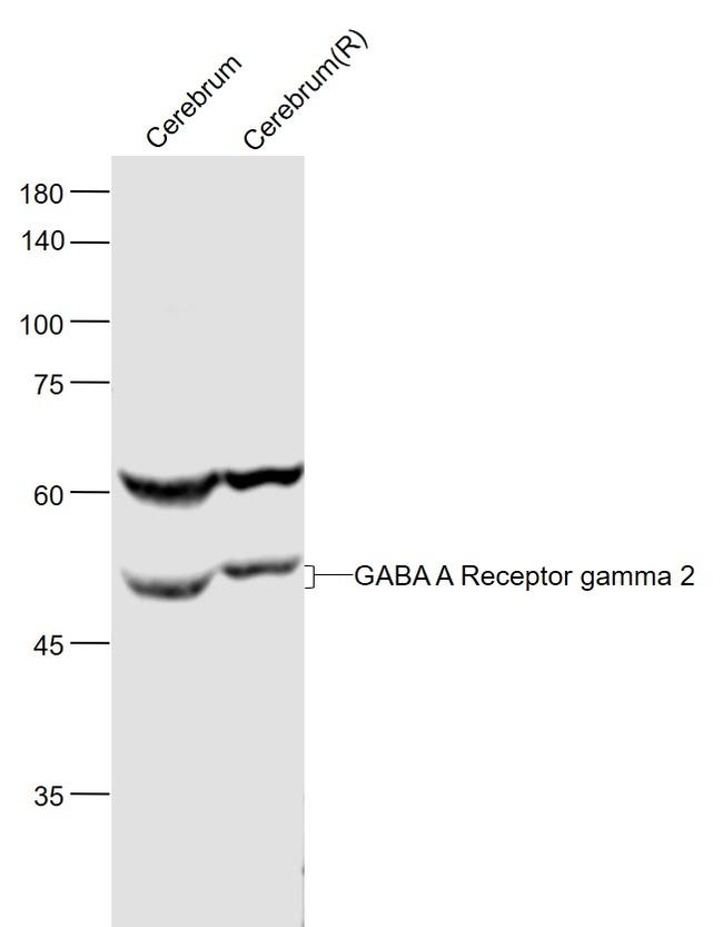 GABA A Receptor gamma 2 Antibody in Western Blot (WB)