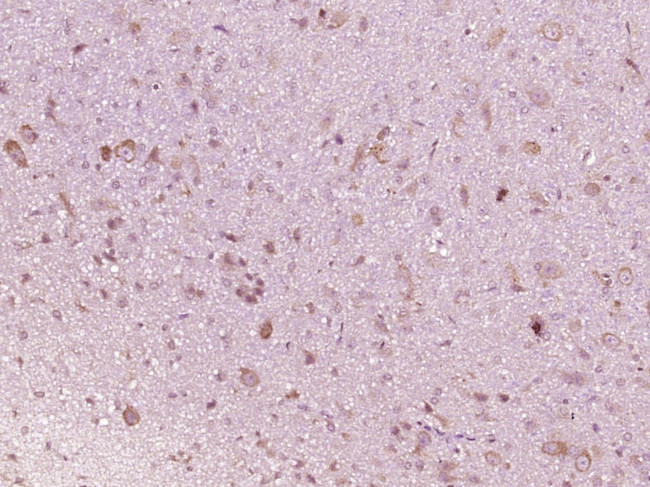 IFNAR1 Antibody in Immunohistochemistry (Paraffin) (IHC (P))