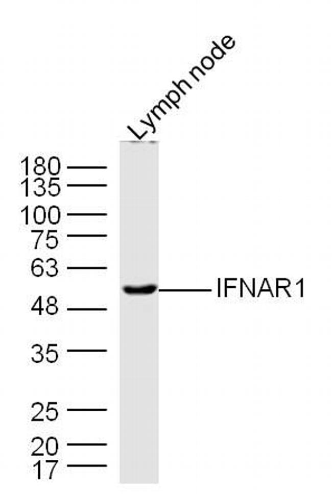 IFNAR1 Antibody in Western Blot (WB)