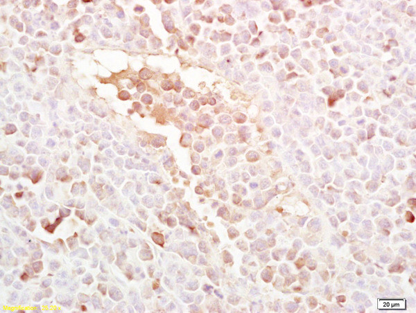 LRP5 Antibody in Immunohistochemistry (Paraffin) (IHC (P))