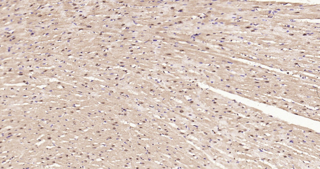 TNMD Antibody in Immunohistochemistry (Paraffin) (IHC (P))