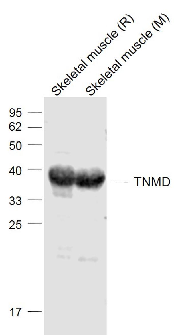 TNMD Antibody in Western Blot (WB)