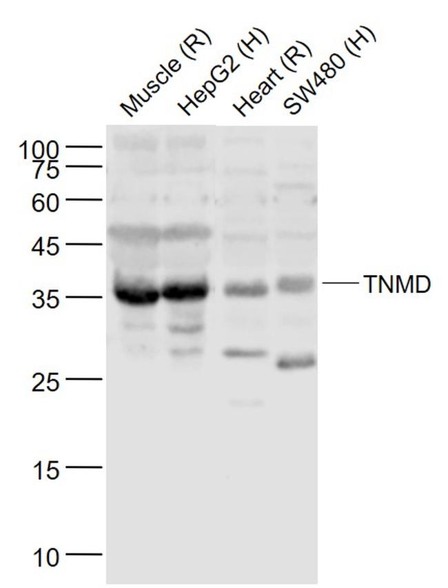 TNMD Antibody in Western Blot (WB)