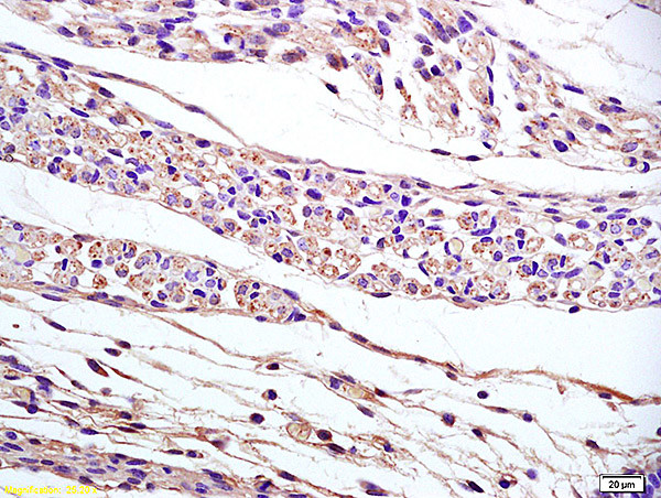 PAP2B Antibody in Immunohistochemistry (Paraffin) (IHC (P))