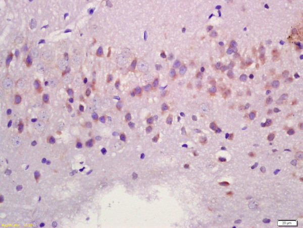 MAPK11 Antibody in Immunohistochemistry (Paraffin) (IHC (P))