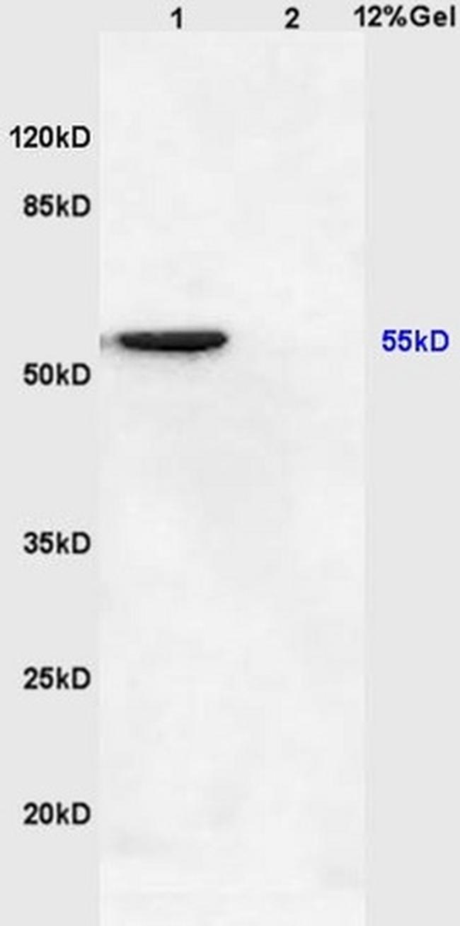 IKB epsilon Antibody in Western Blot (WB)