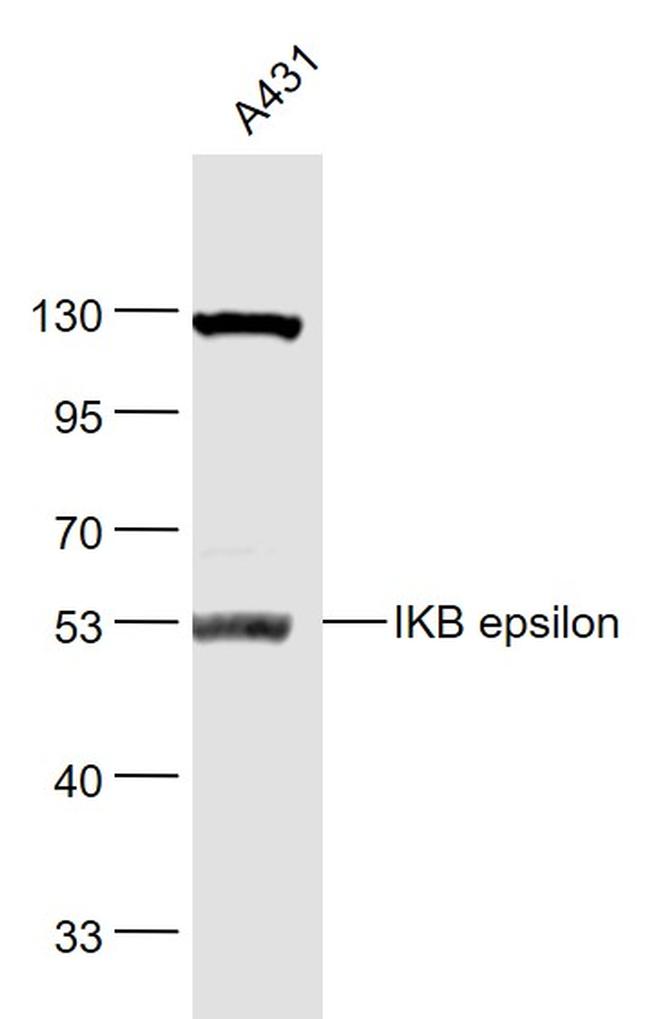 IKB epsilon Antibody in Western Blot (WB)