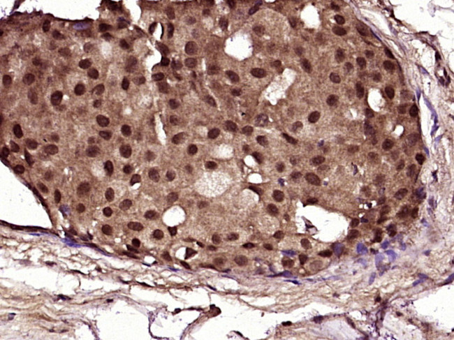 NF1 Antibody in Immunohistochemistry (Paraffin) (IHC (P))