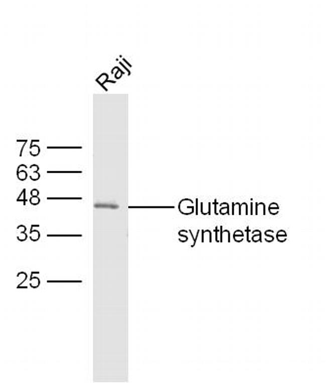 Glutamine synthetase Antibody in Western Blot (WB)