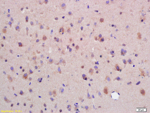 SYTL5 Antibody in Immunohistochemistry (Paraffin) (IHC (P))