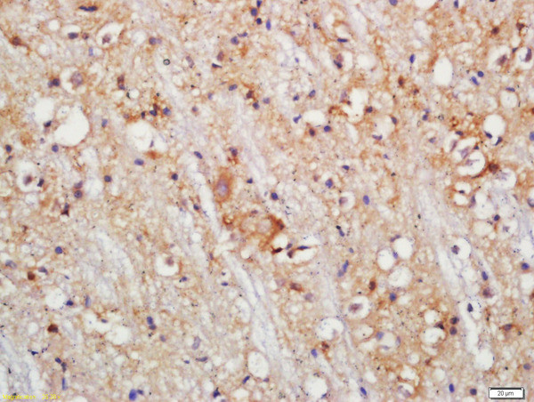 PLCL1 Antibody in Immunohistochemistry (Paraffin) (IHC (P))