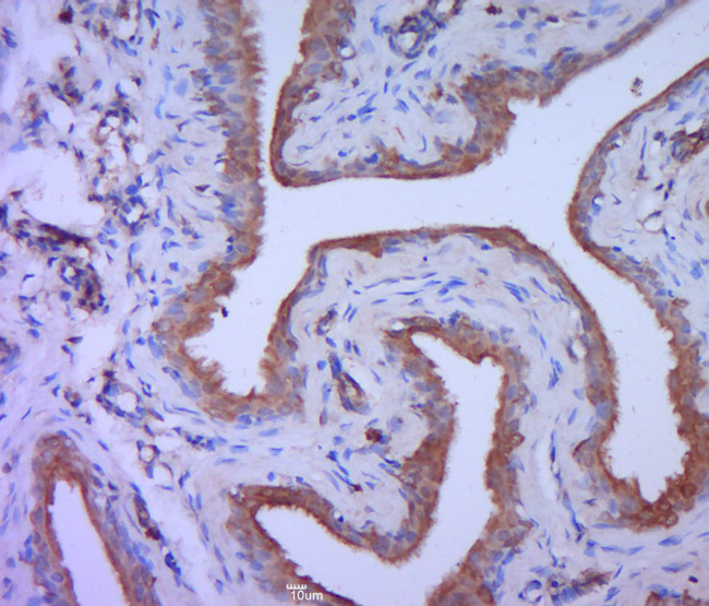 PKC theta Antibody in Immunohistochemistry (Paraffin) (IHC (P))