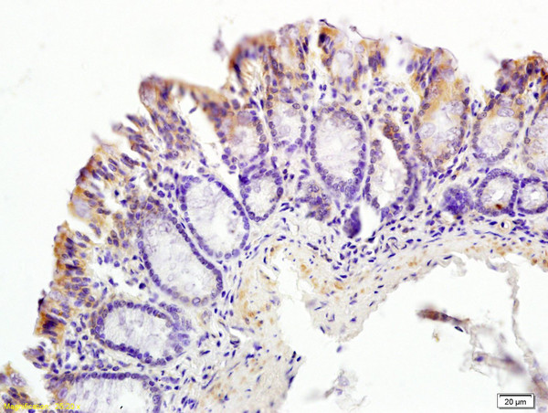 CT054 Antibody in Immunohistochemistry (Paraffin) (IHC (P))