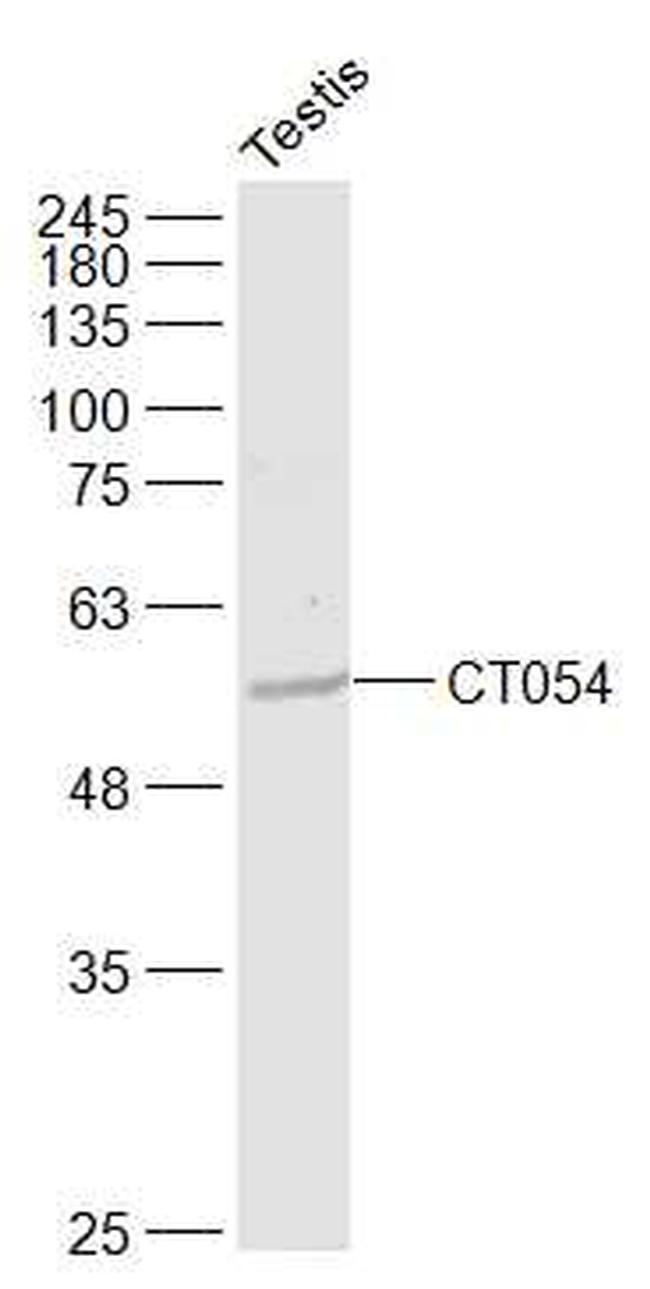 CT054 Antibody in Western Blot (WB)