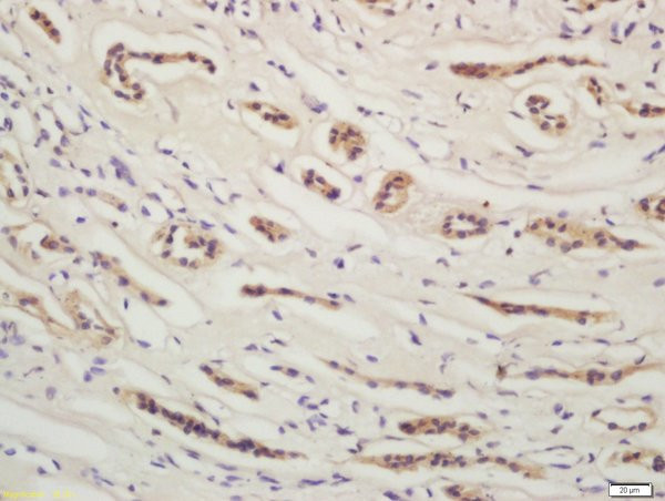 YES1 Antibody in Immunohistochemistry (Paraffin) (IHC (P))