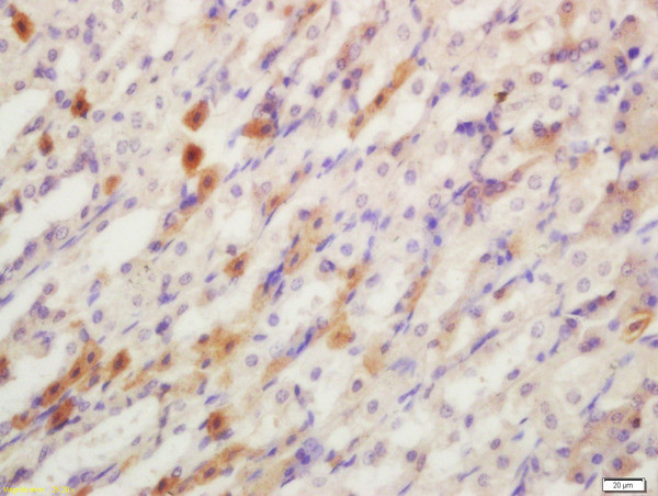 YES1 Antibody in Immunohistochemistry (Paraffin) (IHC (P))