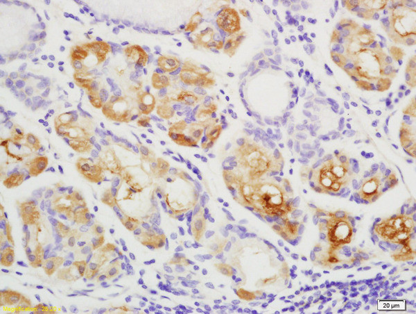 YES1 Antibody in Immunohistochemistry (Paraffin) (IHC (P))