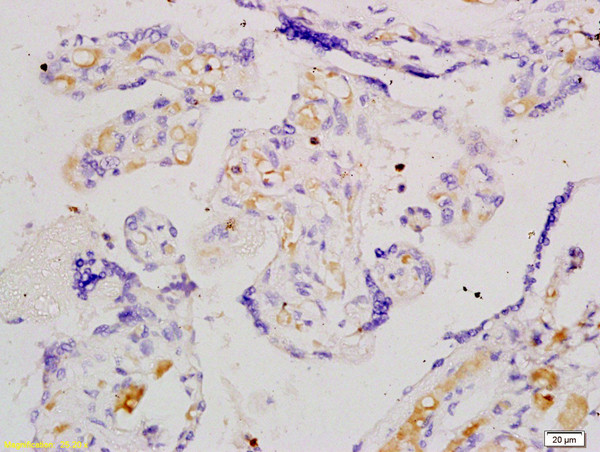 Angiomotin Antibody in Immunohistochemistry (Paraffin) (IHC (P))