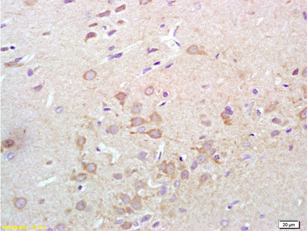 Synaptotagmin Antibody in Immunohistochemistry (Paraffin) (IHC (P))