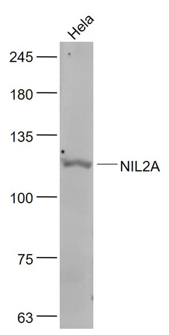 ZEB1/2 Antibody in Western Blot (WB)