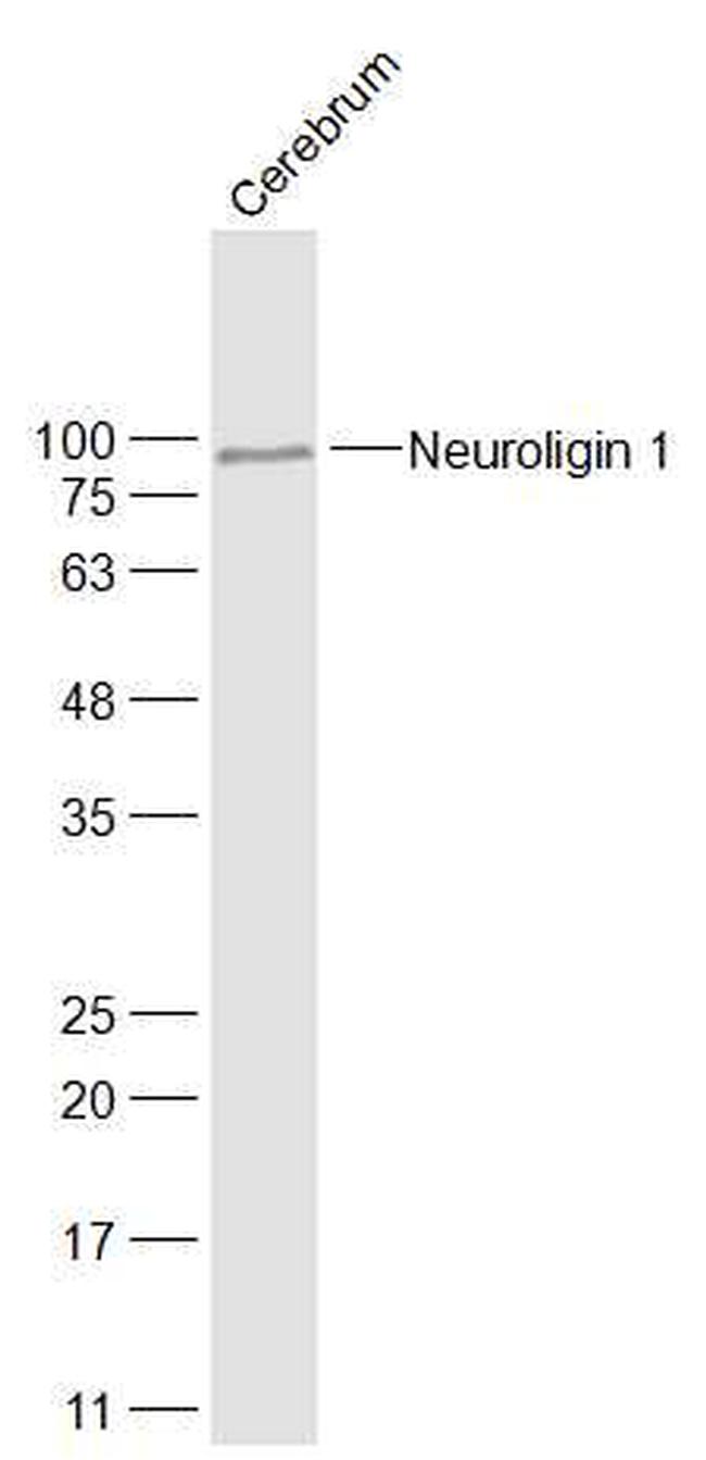 Neuroligin 1 Antibody in Western Blot (WB)